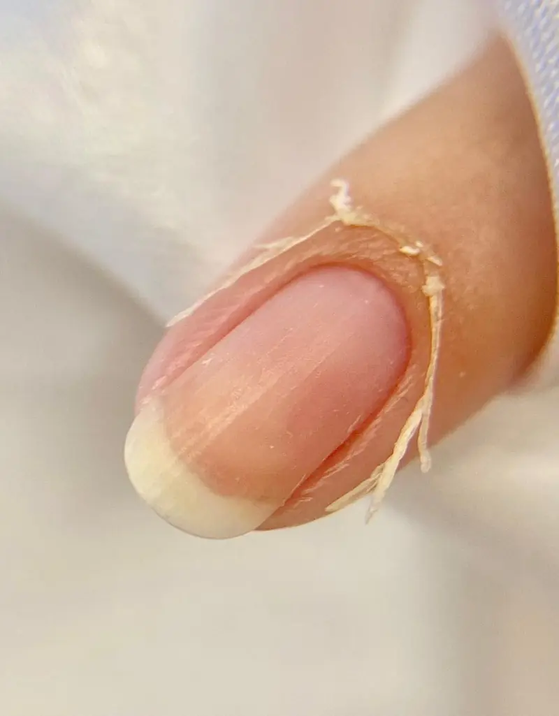 Continuous cuticle removal technique